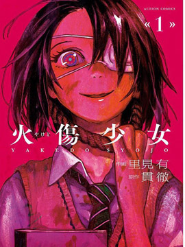 火伤少女