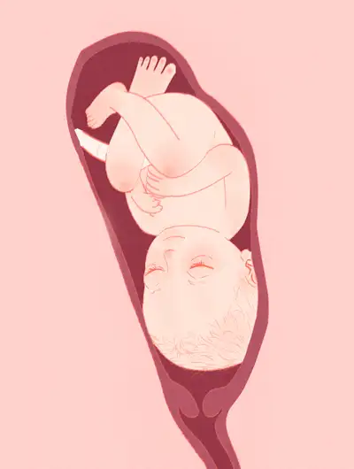 女娃